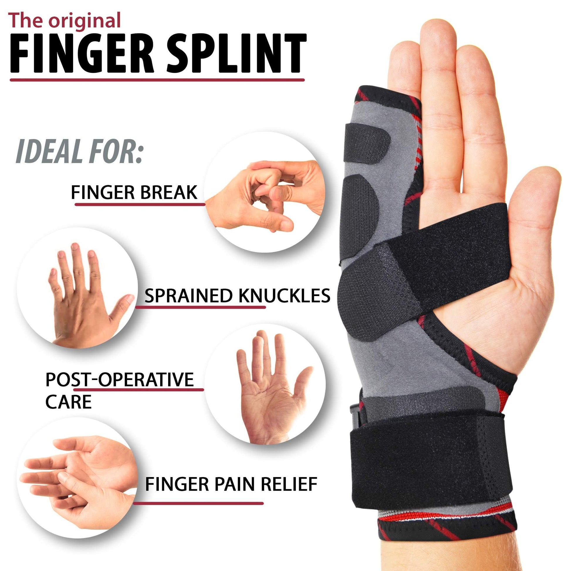 ORTONYX boxer fracture splint ACKB434, ulnar-side brace immobilizing 4th–5th digits with straps; pinky finger brace.